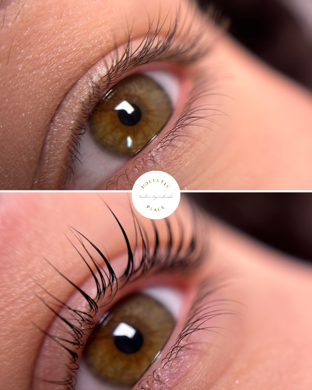 Efekt zabiegu przed i po