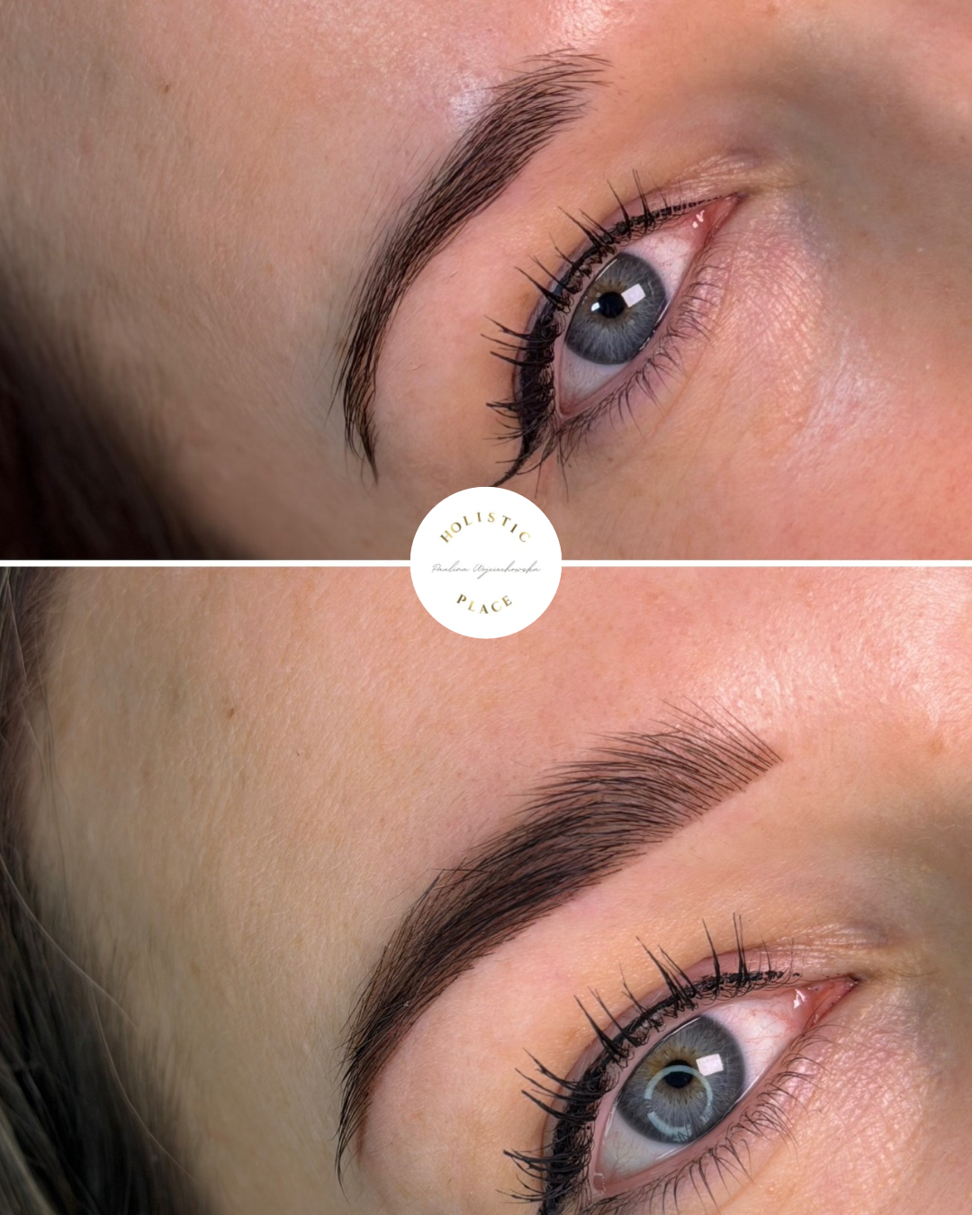 Efekt zabiegu przed i po