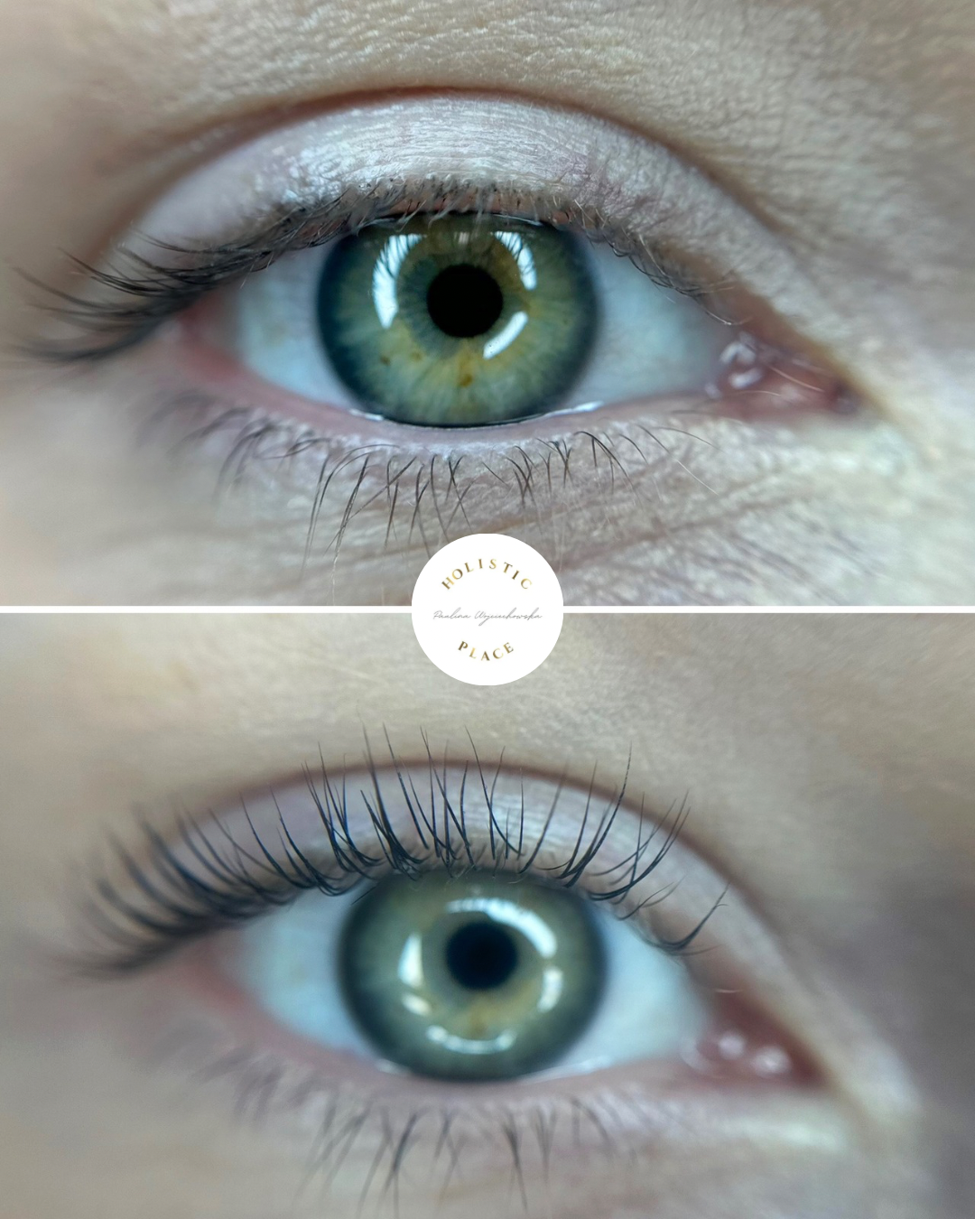 Efekt zabiegu przed i po