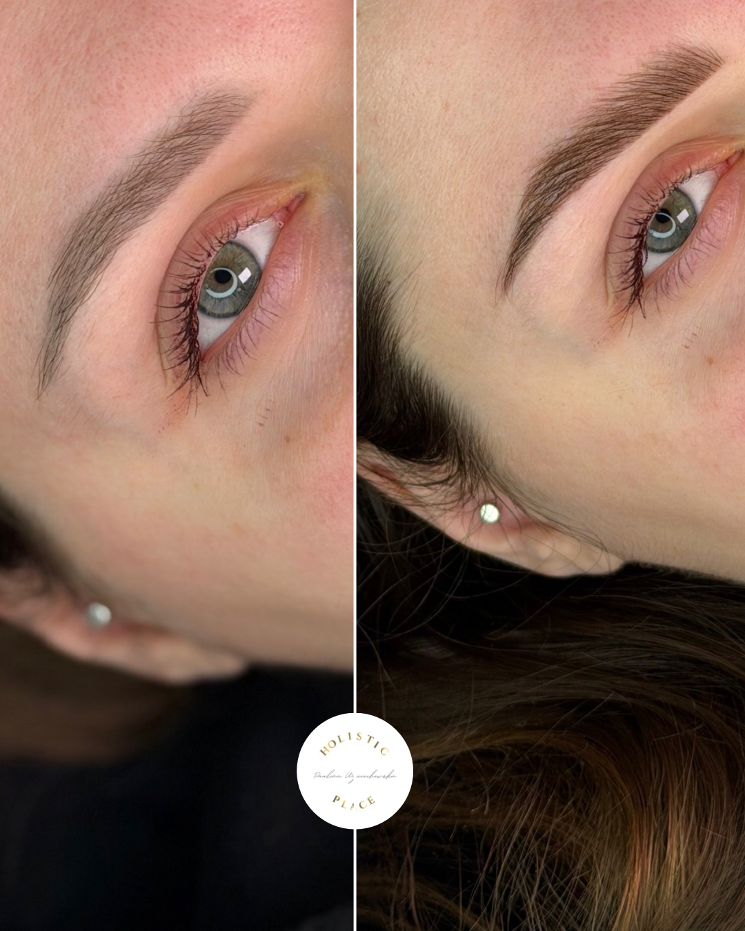 Efekt zabiegu przed i po